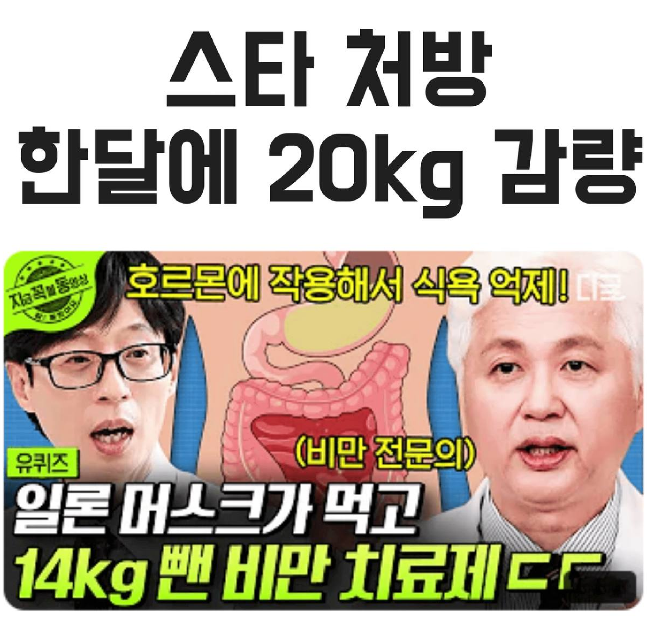건강한 체중 관리 보조 제품
