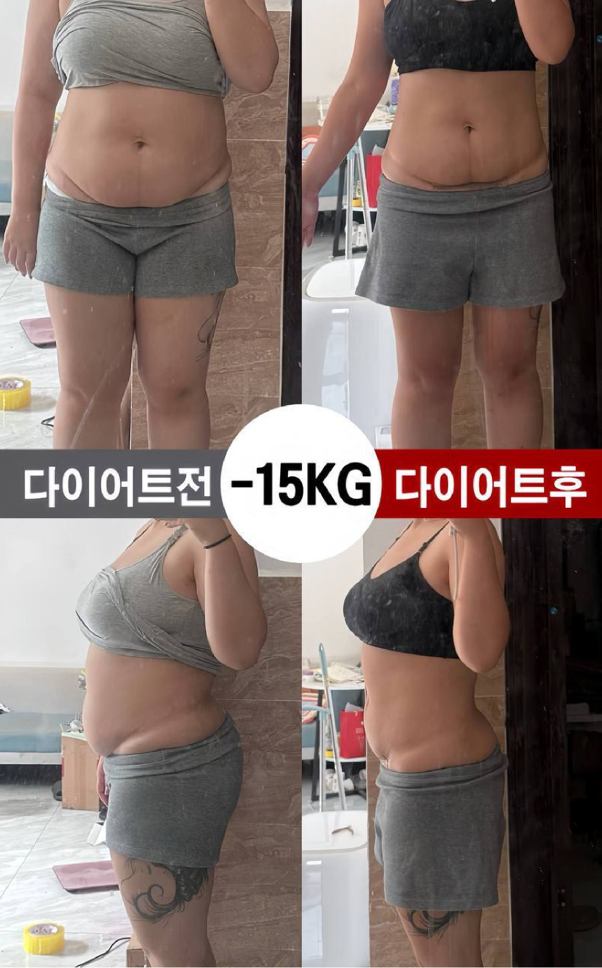 건강 관리 사례