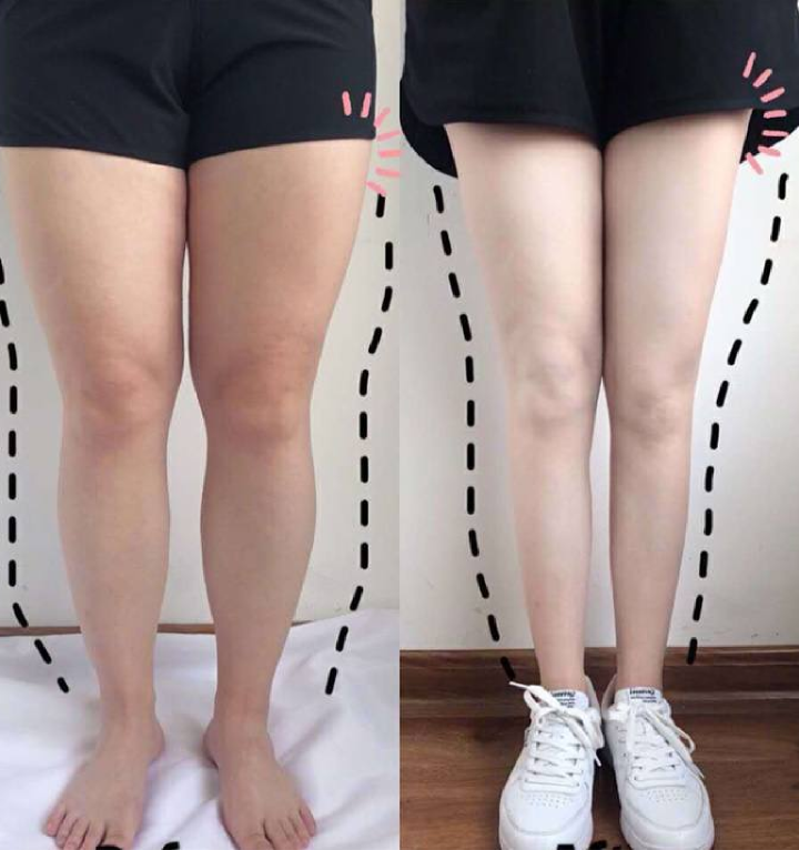 웰빙 라이프스타일